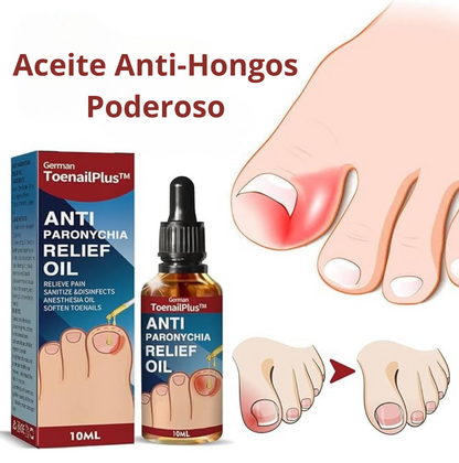 📌 Pies Sin Vergüenza™ – Aceite Anti-Hongos Poderoso